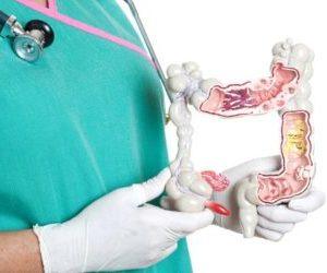 как лечить язвенный колит кишечника народными средствами