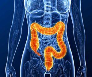 Что такое эндометриоз прямой кишки и его симптомы