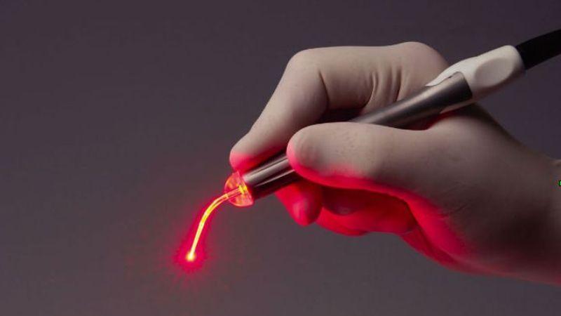 лечение геморроя операция лазером