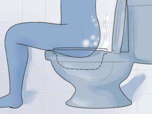 как остановить кровотечение при геморрое в домашних условиях