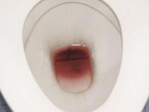 кровоостанавливающее при геморрое