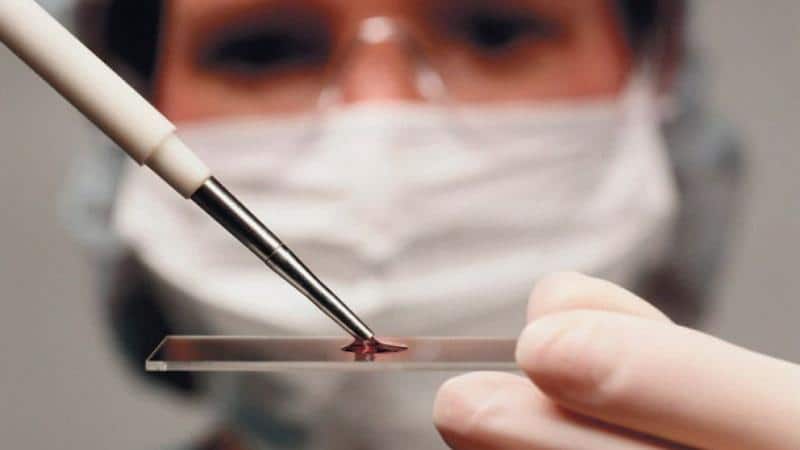 анализ крови пробное стекло с кровью