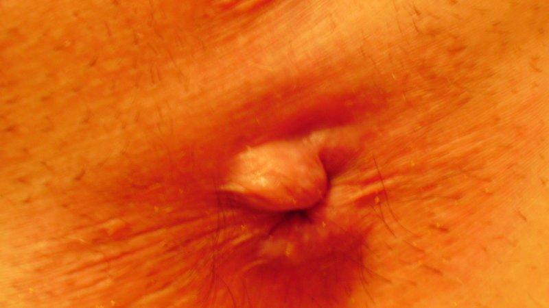 какие антибиотики пить при внутреннем геморрое