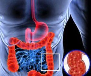 Лечебные клизмы при колите кишечника: рецепты и отзывы