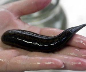 гирудотерапия отзывы при геморрое