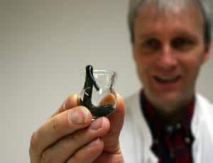 пиявки от геморроя отзывы