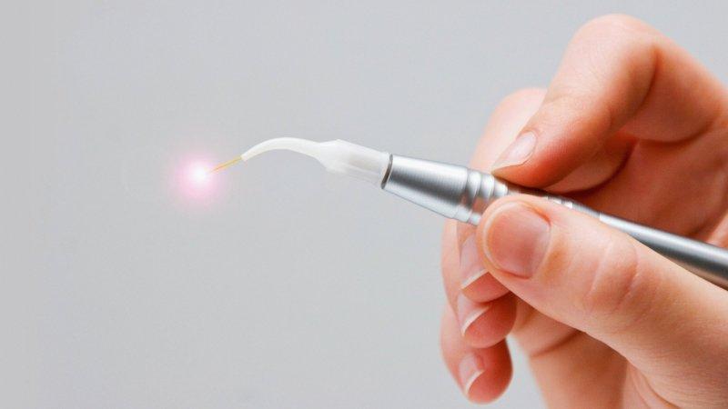 прижигание геморроя лазером отзывы