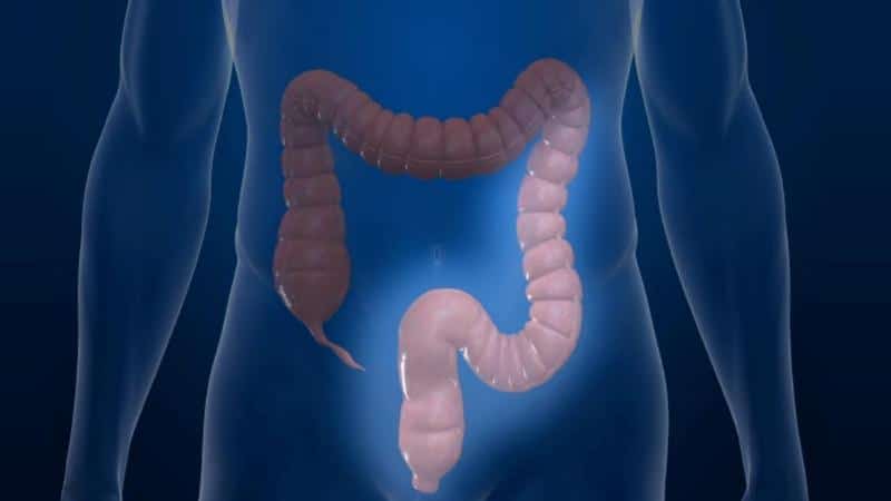 лечение колита кишечника у женщин