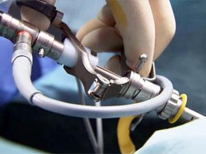 Как проводится операция лазером при простатите и отзывы