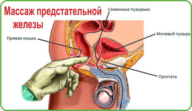 массаж при простатите в домашних условиях