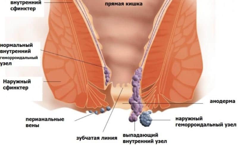 мазь левомеколь при геморрое инструкция по применению и отзывы