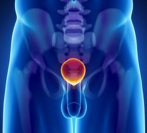 Какие могут быть выделения у мужчин при простатите и что делать