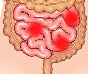 Что такое колоноскопия - противопоказания и отзывы