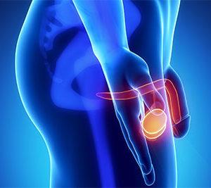 Баня и сауна при простатите: можно ли париться при аденоме простаты