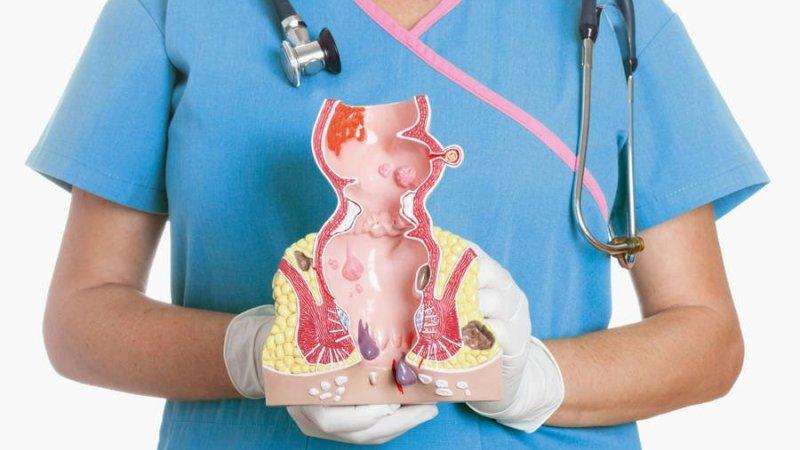 народные средства от геморроя