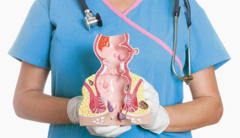 дешевые препараты от геморроя