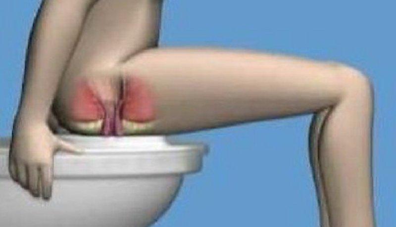 тренировка мышц сфинктера