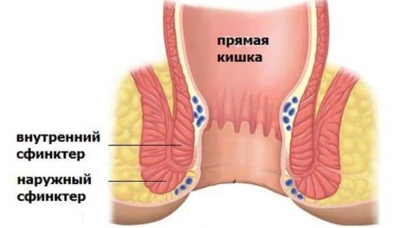 как укрепить сфинктер прямой кишки