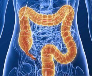 классификация