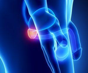 Препарат Офлоксацин: инструкция по применению при простатите и отзывы