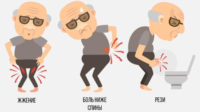 признаки острого простатита