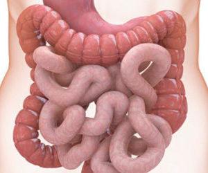 Что такое перфорация стенок кишечника