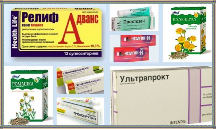 прострелы в заднем проходе у женщин причины