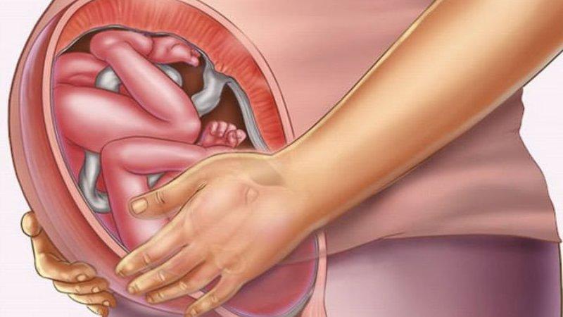 при беременности колит живот на ранних сроках беременности