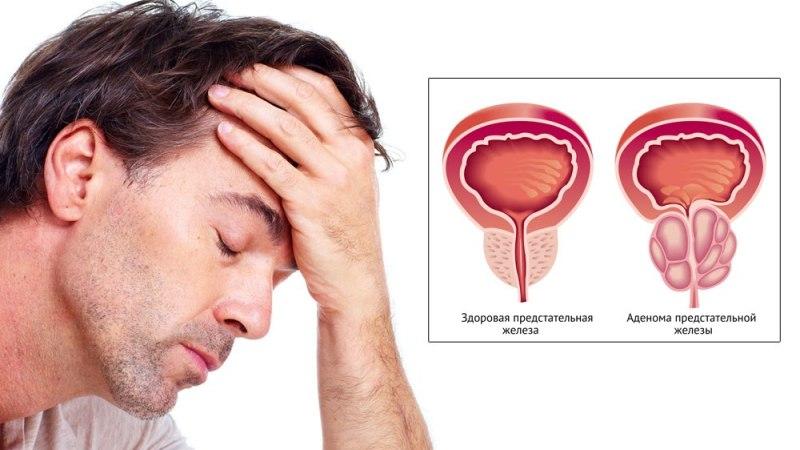 от чего у мужчин бывает простатит
