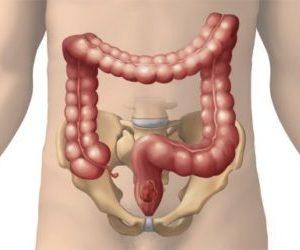 онкология симптомы и признаки болезни прямой кишки у женщин