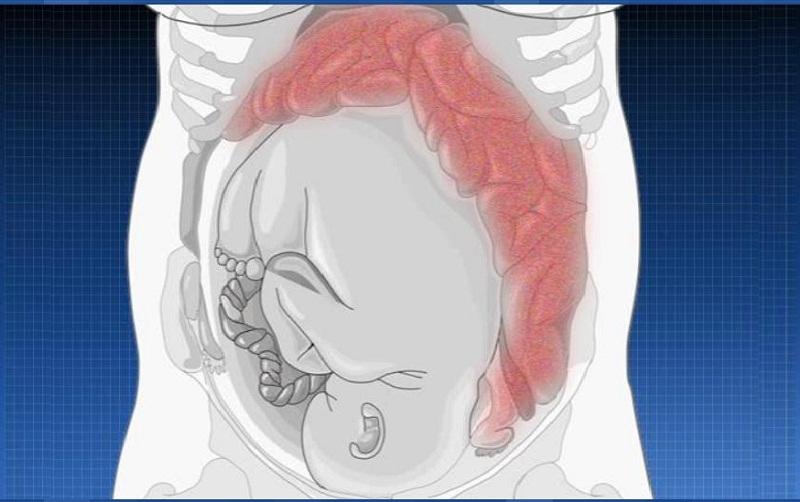 женщина в положении и давление на кишечник