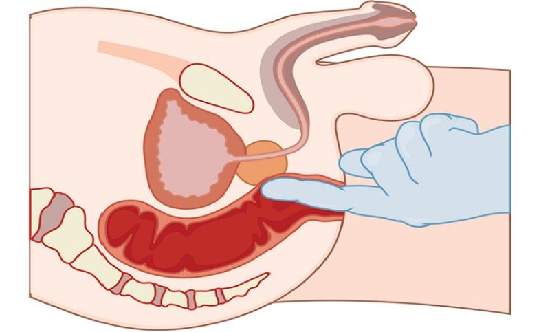 хирург проктолог это кто