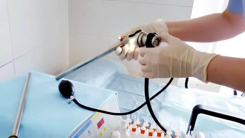 ректоскопия прямой кишки отзывы