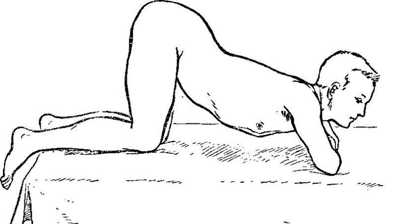 как подготовиться к ректоскопии прямой кишки