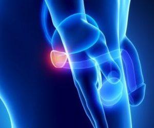 Хронический простатит в стадии ремиссии