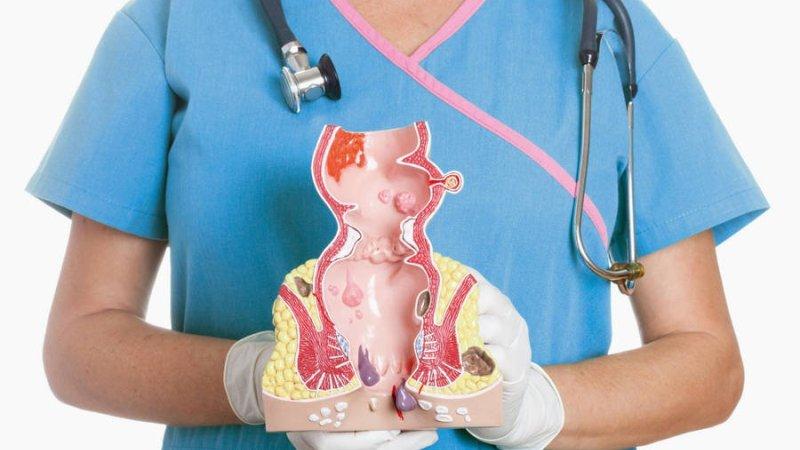 чем лучше лечить геморрой