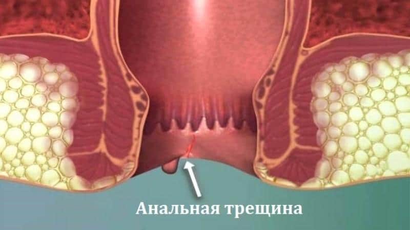 сфинктер у женщин что это