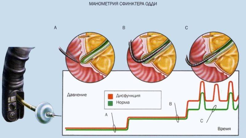 сфинктер одди расположение