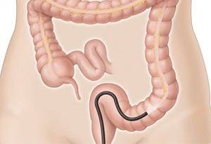 сфинктер как расслабить