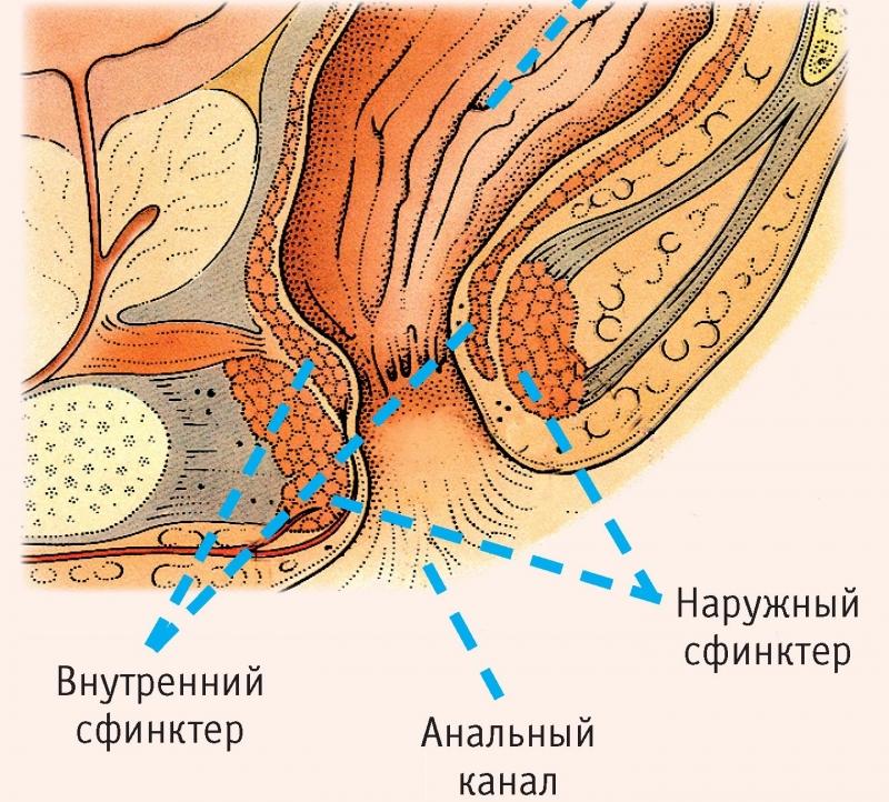 симптомы спазма сфинктера прямой кишки