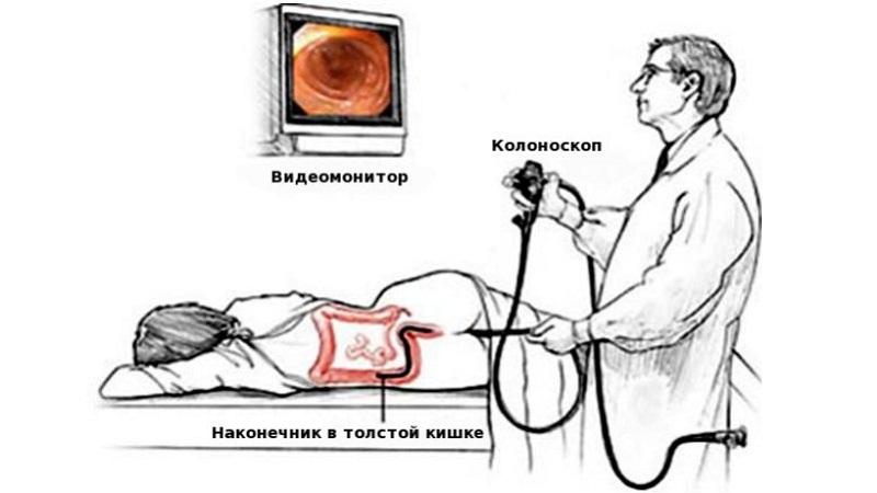 запор спастический у ребенка