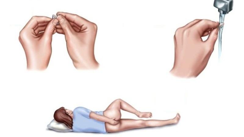 как применять ректальные свечи