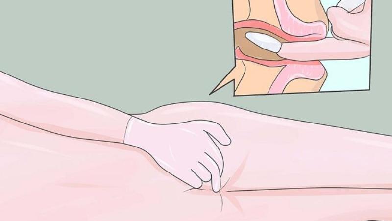 какие лучше свечи релиф от геморроя