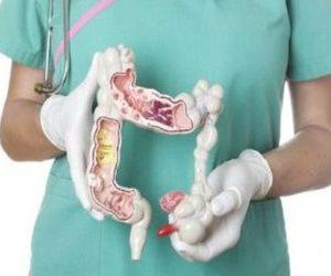 Какие есть свечи с новокаином и как их применять