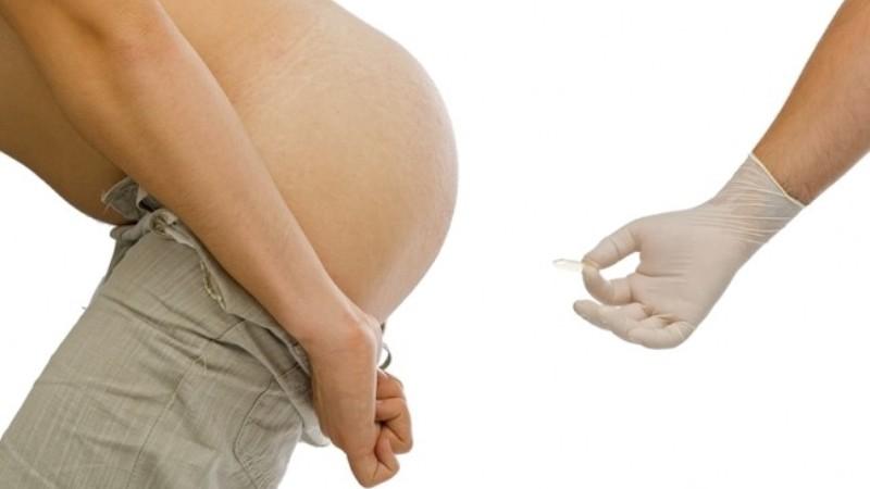 трещина заднего прохода симптомы и лечение фото