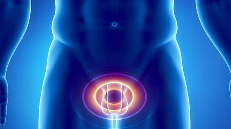 признаки хронического простатита у мужчин