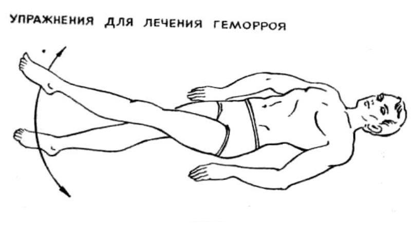 физические упражнения при геморрое у мужчин