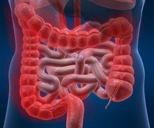 Что такое ворсинчатая опухоль прямой кишки: симптомы и лечение