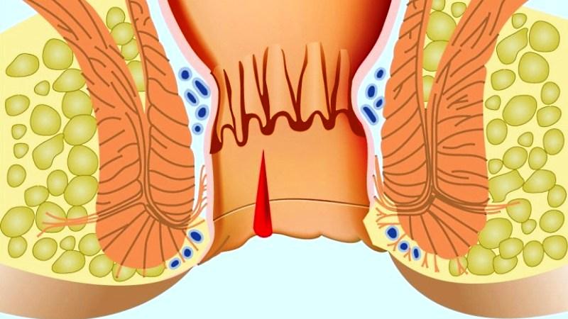 выходит слизь из заднего прохода причины у взрослых