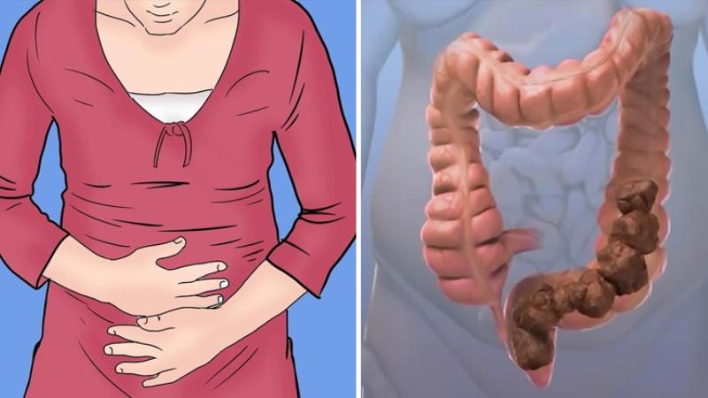 запор что срочно делать